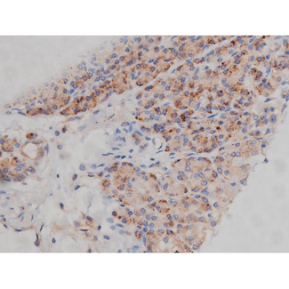 SYN / FYN Antibody - 1:200 staining human pancreas tissue by IHC-P. The tissue was formaldehyde fixed and a heat mediated antigen retrieval step in citrate buffer was performed. The tissue was then blocked and incubated with the antibody for 1.5 hours at 22°C. An HRP conjugated goat anti-rabbit antibody was used as the secondary.