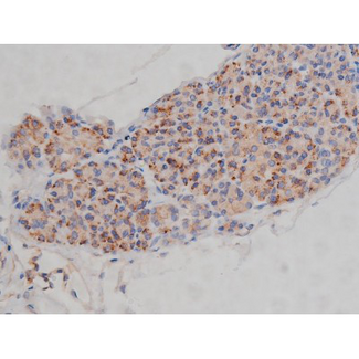 SYN / FYN Antibody - 1:200 staining human pancreas tissue by IHC-P. The tissue was formaldehyde fixed and a heat mediated antigen retrieval step in citrate buffer was performed. The tissue was then blocked and incubated with the antibody for 1.5 hours at 22°C. An HRP conjugated goat anti-rabbit antibody was used as the secondary.