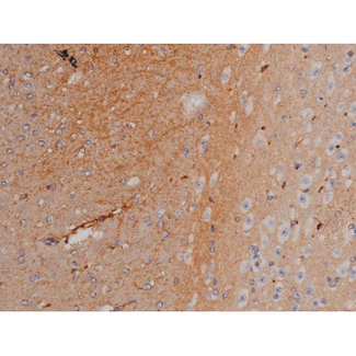 SYN / FYN Antibody - 1:200 staining mouse brain tissue by IHC-P. The tissue was formaldehyde fixed and a heat mediated antigen retrieval step in citrate buffer was performed. The tissue was then blocked and incubated with the antibody for 1.5 hours at 22°C. An HRP conjugated goat anti-rabbit antibody was used as the secondary.
