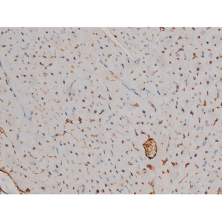 SYN / FYN Antibody - 1:200 staining mouse heart tissue by IHC-P. The tissue was formaldehyde fixed and a heat mediated antigen retrieval step in citrate buffer was performed. The tissue was then blocked and incubated with the antibody for 1.5 hours at 22°C. An HRP conjugated goat anti-rabbit antibody was used as the secondary.