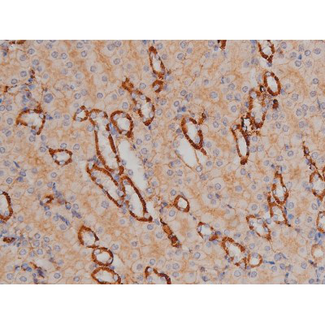 SYN / FYN Antibody - 1:200 staining mouse kidney tissue by IHC-P. The tissue was formaldehyde fixed and a heat mediated antigen retrieval step in citrate buffer was performed. The tissue was then blocked and incubated with the antibody for 1.5 hours at 22°C. An HRP conjugated goat anti-rabbit antibody was used as the secondary.