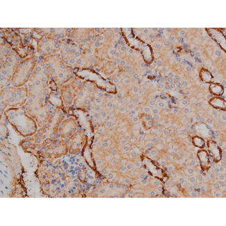 SYN / FYN Antibody - 1:200 staining mouse kidney tissue by IHC-P. The tissue was formaldehyde fixed and a heat mediated antigen retrieval step in citrate buffer was performed. The tissue was then blocked and incubated with the antibody for 1.5 hours at 22°C. An HRP conjugated goat anti-rabbit antibody was used as the secondary.