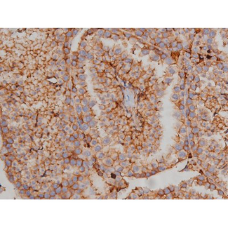 SYN / FYN Antibody - 1:200 staining mouse testis tissue by IHC-P. The tissue was formaldehyde fixed and a heat mediated antigen retrieval step in citrate buffer was performed. The tissue was then blocked and incubated with the antibody for 1.5 hours at 22°C. An HRP conjugated goat anti-rabbit antibody was used as the secondary.