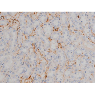 SYN / FYN Antibody - 1:200 staining rat kidney tissue by IHC-P. The tissue was formaldehyde fixed and a heat mediated antigen retrieval step in citrate buffer was performed. The tissue was then blocked and incubated with the antibody for 1.5 hours at 22°C. An HRP conjugated goat anti-rabbit antibody was used as the secondary.
