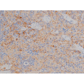 SYN / FYN Antibody - 1:200 staining rat spleen tissue by IHC-P. The tissue was formaldehyde fixed and a heat mediated antigen retrieval step in citrate buffer was performed. The tissue was then blocked and incubated with the antibody for 1.5 hours at 22°C. An HRP conjugated goat anti-rabbit antibody was used as the secondary.