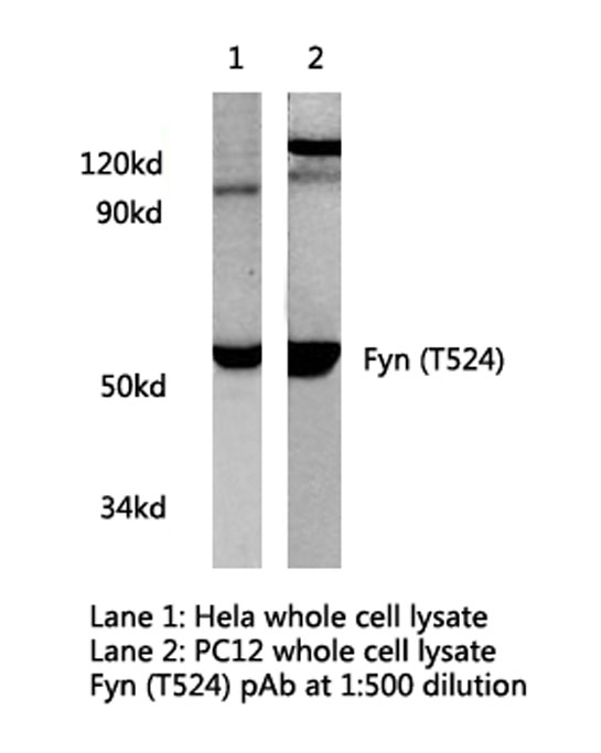 SYN / FYN Antibody - Western blot of Fyn (T524) pAb in extracts from HeLa and PC12 cells.