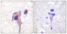 SYN1 / Synapsin 1 Antibody - Immunohistochemistry analysis of paraffin-embedded human brain tissue, using Synapsin1 Antibody. The picture on the right is blocked with the synthesized peptide.