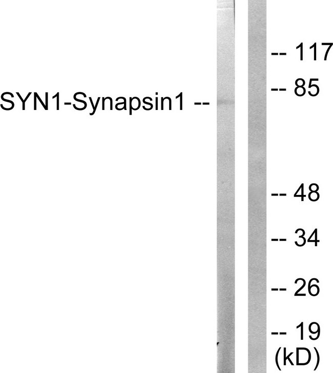 SYN1 / Synapsin 1 Antibody - Western blot analysis of lysates from NIH/3T3 cells, treated with Nocodazole 1ug/ml 16h, using Synapsin1 Antibody. The lane on the right is blocked with the synthesized peptide.