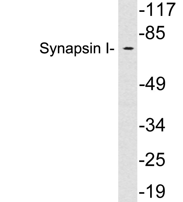 SYN1 / Synapsin 1 Antibody - Western blot analysis of lysates from HeLa cells, using Synapsin I antibody.