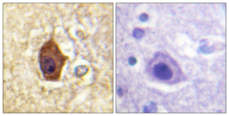 SYN1 / Synapsin 1 Antibody - Immunohistochemistry analysis of paraffin-embedded human brain tissue, using Synapsin1 Antibody. The picture on the right is blocked with the synthesized peptide.
