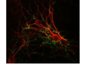 SYN1 / Synapsin 1 Antibody - Immunostaining of cultured rat caudate neurons showing punctate distribution of synapsin in green and MAP in red.