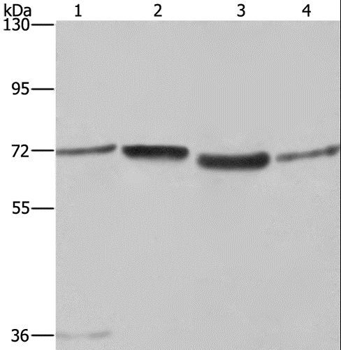 SYN1 / Synapsin 1 Antibody - Western blot analysis of A375 and 231 cell, 293T cell and human hepatocellular carcinoma tissue, using SYN1 Polyclonal Antibody at dilution of 1:550.