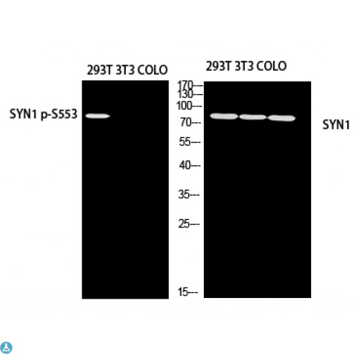 SYN1 / Synapsin 1 Antibody - Western Blot (WB) analysis of 293T using SYN1 p-S553 antibody.