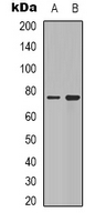 SYN1 / Synapsin 1 Antibody - Western blot analysis of Synapsin 1 expression in HeLa (A); mouse brain (B) whole cell lysates.