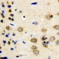 SYN1 / Synapsin 1 Antibody - Immunohistochemical analysis of Synapsin 1 staining in human brain formalin fixed paraffin embedded tissue section. The section was pre-treated using heat mediated antigen retrieval with sodium citrate buffer (pH 6.0). The section was then incubated with the antibody at room temperature and detected using an HRP polymer system. DAB was used as the chromogen. The section was then counterstained with hematoxylin and mounted with DPX.