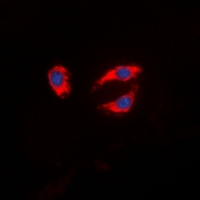 SYN1 / Synapsin 1 Antibody - Immunofluorescent analysis of Synapsin 1 staining in MCF7 cells. Formalin-fixed cells were permeabilized with 0.1% Triton X-100 in TBS for 5-10 minutes and blocked with 3% BSA-PBS for 30 minutes at room temperature. Cells were probed with the primary antibody in 3% BSA-PBS and incubated overnight at 4 deg C in a humidified chamber. Cells were washed with PBST and incubated with a DyLight 594-conjugated secondary antibody (red) in PBS at room temperature in the dark. DAPI was used to stain the cell nuclei (blue).