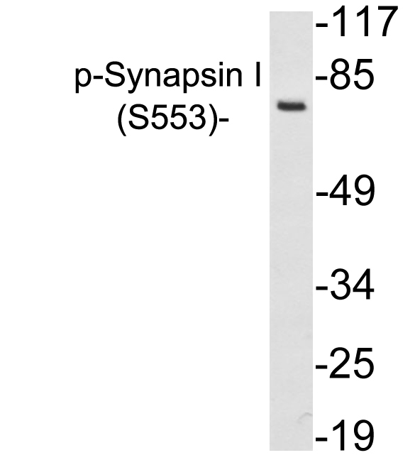 SYN1 / Synapsin 1 Antibody - Western blot analysis of lysates from 293 cells treated with PMA, using p-Serynapsin I (Phospho-Ser553) antibody.