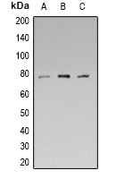 SYN1 / Synapsin 1 Antibody - Western blot analysis of Synapsin 1 (pS553) expression in HEK293T (A); mouse brain (B); rat brain (C) whole cell lysates.