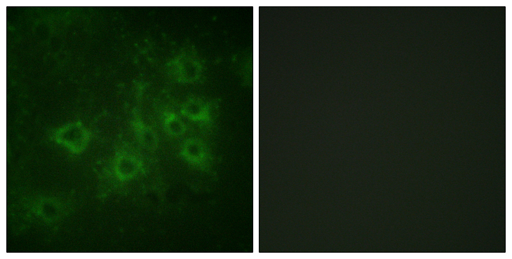 SYN1 / Synapsin 1 Antibody - Immunofluorescence analysis of COS7 cells, using Synapsin1 (Phospho-Ser605) Antibody. The picture on the right is blocked with the phospho peptide.