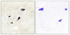 SYN1 / Synapsin 1 Antibody - Immunohistochemistry analysis of paraffin-embedded human brain, using Synapsin1 (Phospho-Ser605) Antibody. The picture on the right is blocked with the phospho peptide.