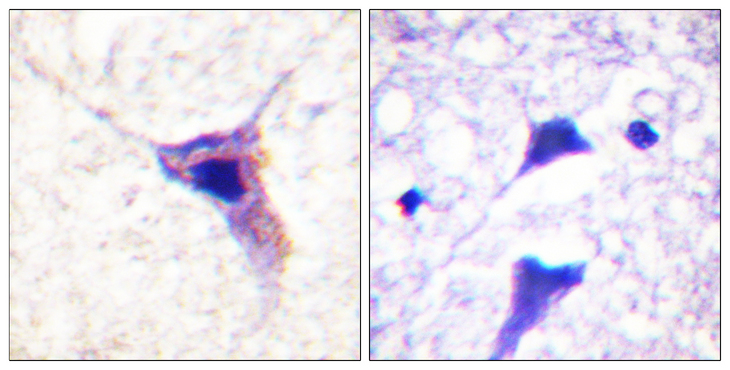 SYN1 / Synapsin 1 Antibody - Immunohistochemistry analysis of paraffin-embedded human brain, using Synapsin1 (Phospho-Ser62) Antibody. The picture on the right is blocked with the phospho peptide.