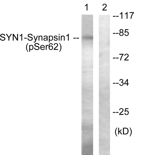 SYN1 / Synapsin 1 Antibody - Western blot analysis of lysates from HeLa cells treated with Anisomycin 25ug/ml 30', using Synapsin1 (Phospho-Ser62) Antibody. The lane on the right is blocked with the phospho peptide.
