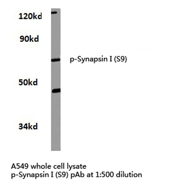 SYN1 / Synapsin 1 Antibody - Western blot of p-Synapsin I (S9) pAb in extracts from A549 cells.