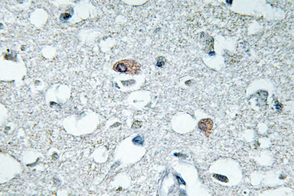 SYN1 / Synapsin 1 Antibody - IHC of p-Synapsin I (S9) pAb in paraffin-embedded human brain tissue.