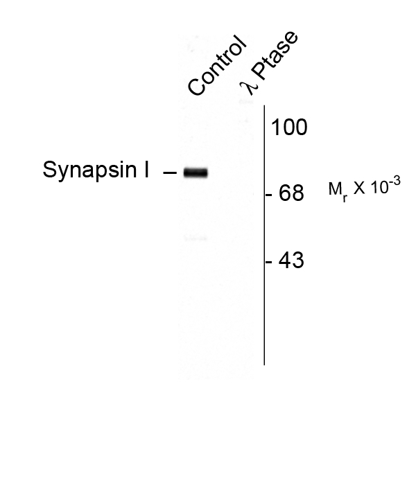 SYN1 / Synapsin 1 Antibody - Western blot of rat cortex lysate showing specific immunolabeling of the ~78k synapsin I phosphorylated at Ser9 (Control). The phosphospecificity of this labeling is shown in the second lane (lambda-phosphates: I-Ptase). The blot is identical to the control except that it was incubated in I-Ptase (1200 units for 30 min) before being exposed to the phospho-Ser9 synapsin I antibody. The immunolabeling is completely eliminated by the treatment with I-Ptase.