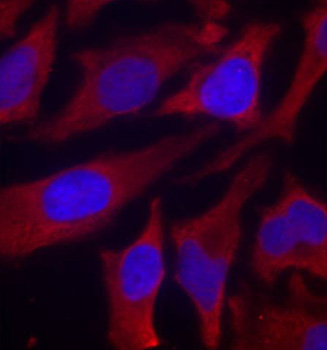 SYN1 / Synapsin 1 Antibody - Immunofluorescence staining of methanol-fixed Hela cells.