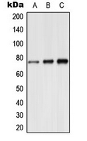 SYN1 / Synapsin 1 Antibody - Western blot analysis of Synapsin 1 (pS9) expression in A549 (A); mouse brain (B); rat brain (C) whole cell lysates.