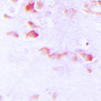 SYN1 / Synapsin 1 Antibody - Immunohistochemical analysis of Synapsin 1 (pS9) staining in human brain formalin fixed paraffin embedded tissue section. The section was pre-treated using heat mediated antigen retrieval with sodium citrate buffer (pH 6.0). The section was then incubated with the antibody at room temperature and detected using an HRP conjugated compact polymer system. DAB was used as the chromogen. The section was then counterstained with hematoxylin and mounted with DPX.