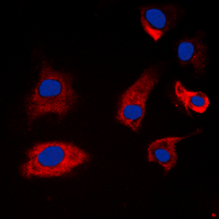 SYN1 / Synapsin 1 Antibody - Immunofluorescent analysis of Synapsin 1 (pS9) staining in A549 cells. Formalin-fixed cells were permeabilized with 0.1% Triton X-100 in TBS for 5-10 minutes and blocked with 3% BSA-PBS for 30 minutes at room temperature. Cells were probed with the primary antibody in 3% BSA-PBS and incubated overnight at 4 C in a humidified chamber. Cells were washed with PBST and incubated with a DyLight 594-conjugated secondary antibody (red) in PBS at room temperature in the dark. DAPI was used to stain the cell nuclei (blue).