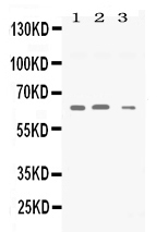 SYN2 / Synapsin II Antibody - Western blot - Anti-Synapsin II Picoband Antibody