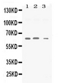 SYN2 / Synapsin II Antibody - Western blot - Anti-Synapsin II Picoband Antibody