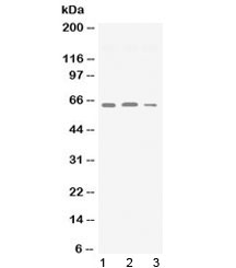 SYN2 / Synapsin II Antibody - Western blot testing of 1) rat brain, 2) mouse brain and 3) human U87 lysate with Synapsin II antibody at 0.5ug/ml. Predicted molecular weight ~63 kDa.