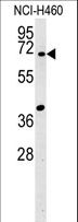 SYN3 / Synapsin III Antibody - SYN3 Antibody western blot of NCI-H460 cell line lysates (15 ug/lane). The SYN3 antibody detected the SYN3 protein (arrow).