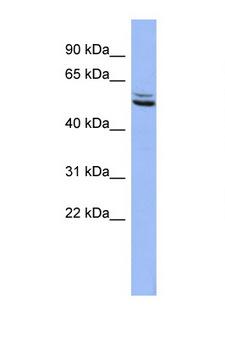 SYN3 / Synapsin III Antibody - SYN3 antibody Western blot of HepG2 Cell lysate. Antibody concentration 1 ug/ml. This image was taken for the unconjugated form of this product. Other forms have not been tested.