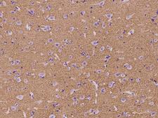 SYN3 / Synapsin III Antibody - Immunochemical staining of human SYN3 in human brain with rabbit polyclonal antibody at 1:100 dilution, formalin-fixed paraffin embedded sections.