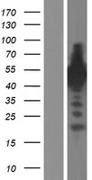 SYN3 / Synapsin III Protein - Western validation with an anti-DDK antibody * L: Control HEK293 lysate R: Over-expression lysate