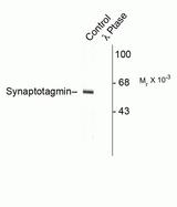 Synaptotagmin Antibody - WB using Phospho-Synaptotagmin pThr202 Antibody