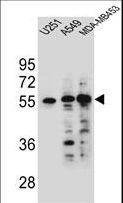 SYNC / SYNCOILIN Antibody - SYNCI Antibody western blot of U251,A549 and MDA-MB453 cell line lysates (35 ug/lane). The SYNCI antibody detected the SYNCI protein (arrow).
