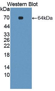 SYNC / SYNCOILIN Antibody - Western blot of SYNC / SYNCOILIN antibody.