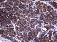 SYNC / SYNCOILIN Antibody - Immunohistochemical staining of paraffin-embedded Human pancreas tissue within the normal limits using anti-SYNC mouse monoclonal antibody. (Heat-induced epitope retrieval by 1mM EDTA in 10mM Tris buffer. (pH8.5) at 120°C for 3 min. (1:150)