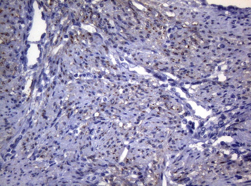 SYNC / SYNCOILIN Antibody - Immunohistochemical staining of paraffin-embedded Human endometrium tissue within the normal limits using anti-SYNC mouse monoclonal antibody. (Heat-induced epitope retrieval by 1mM EDTA in 10mM Tris buffer. (pH8.5) at 120°C for 3 min. (1:150)