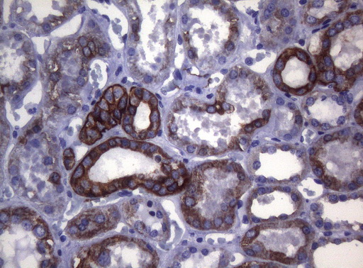 SYNC / SYNCOILIN Antibody - Immunohistochemical staining of paraffin-embedded Human Kidney tissue within the normal limits using anti-SYNC mouse monoclonal antibody. (Heat-induced epitope retrieval by 1mM EDTA in 10mM Tris buffer. (pH8.5) at 120°C for 3 min. (1:150)