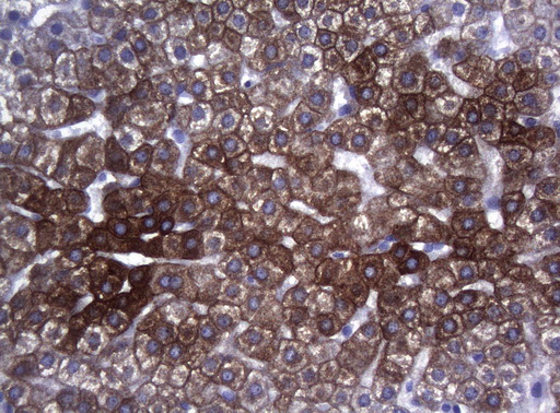 SYNC / SYNCOILIN Antibody - Immunohistochemical staining of paraffin-embedded Human liver tissue within the normal limits using anti-SYNC mouse monoclonal antibody. (Heat-induced epitope retrieval by 1mM EDTA in 10mM Tris buffer. (pH8.5) at 120°C for 3 min. (1:150)