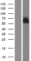 SYNC / SYNCOILIN Protein - Western validation with an anti-DDK antibody * L: Control HEK293 lysate R: Over-expression lysate