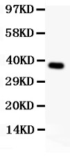 SYNCAM / CADM1 Antibody - SynCAM antibody Western blot. All lanes: Anti SYNCAM at 0.5 ug/ml. WB: Human Recombinant SYNCAM Protein 0.5ng. Predicted band size: 37 kD. Observed band size: 37 kD.
