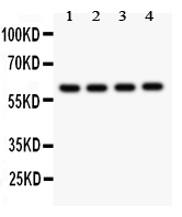 SYNCAM / CADM1 Antibody - Anti-SynCAM Picoband antibody, All lanes: Anti SYNCAM at 0.5ug/ml Lane 1: Rat Brain Tissue Lysate at 50ugLane 2: HELA Whole Cell Lysate at 40ugLane 3: A549 Whole Cell Lysate at 40ugLane 4: JURKAT Whole Cell Lysate at 40ug Predicted bind size: 60KD Observed bind size: 60KD